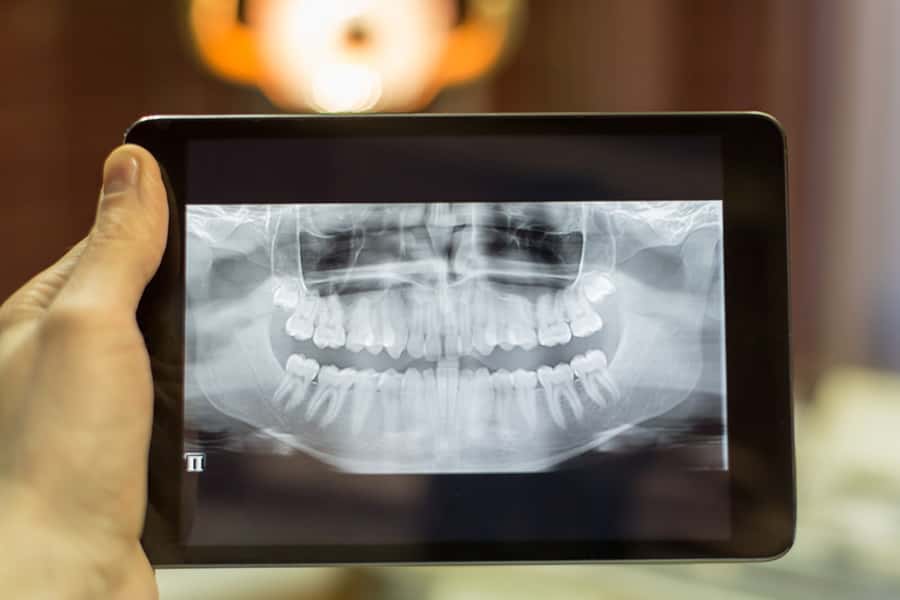 Digital Radiography in Highland Park IL