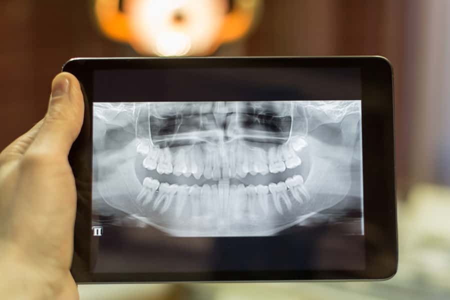 Our pain-free dental office in Highland Park, IL is proud to use advanced dental technology near Highland Park, IL to create an individualized treatment plan just for you! Digital Radiography in Highland Park IL